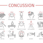 Concussion side effects list