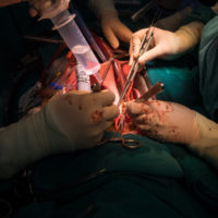 Dr. performing open heart surgury