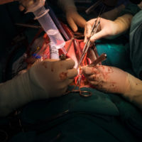 Dr. performing open heart surgury Dr. performing open heart surgury