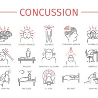 Concussion side effects list Concussion side effects list